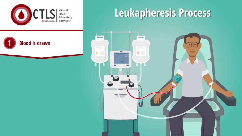 leukapheresis vs apheresis